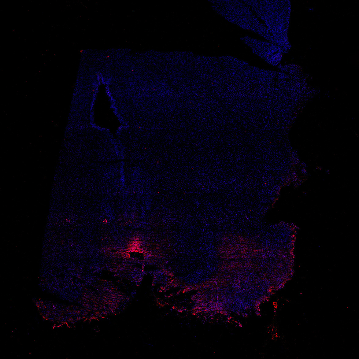 Human foetal midbrain